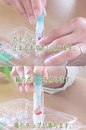 溶液ボトルに吸引器を差し込む