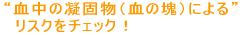 �����̋Ìŕ��i���̌ł܂�j�ɂ�郊�X�N���`�F�b�N
